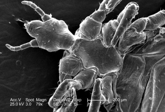 Image of human body louse