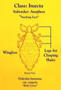 Image of human body louse