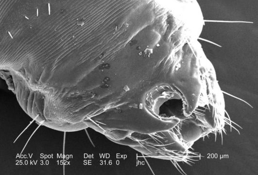 Image of human body louse