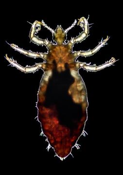 Image of human body louse