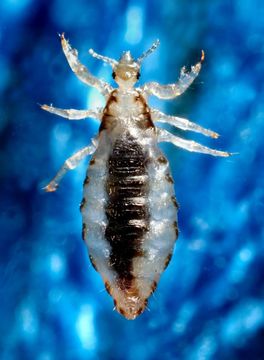 Image of human body louse