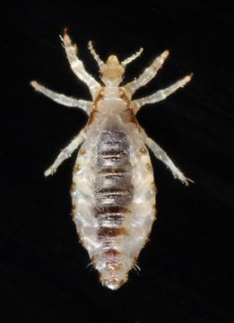 Image of human body louse