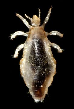 Image of human body louse