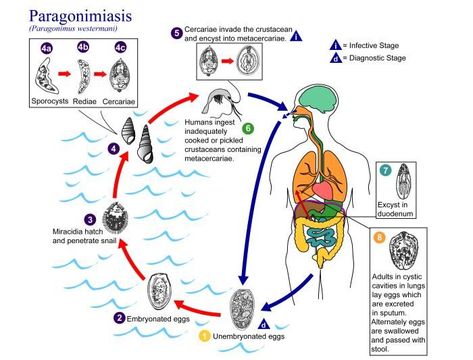 Image of <i>Paragonimus westermanni</i>