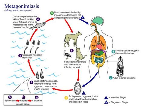 Image of Metagonimiasis