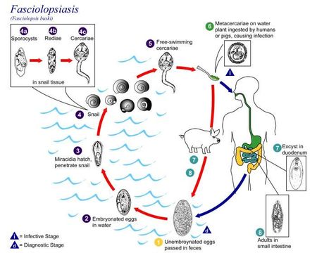 Image de Fasciolopsis