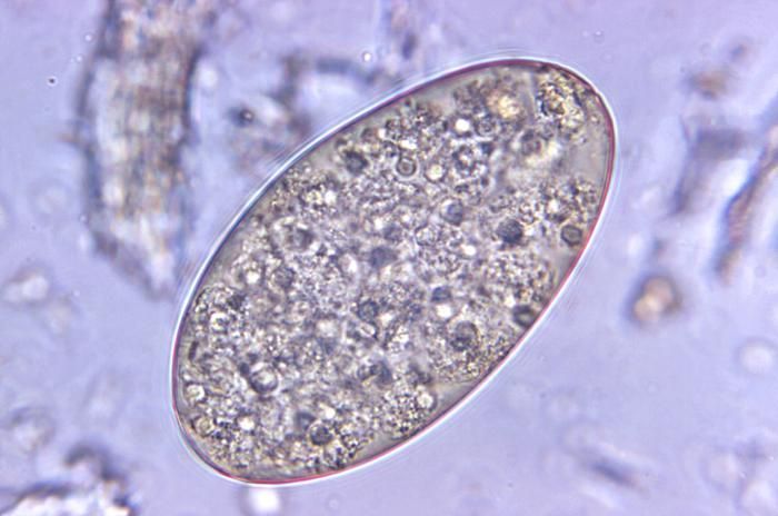 Image of Fasciolopsis
