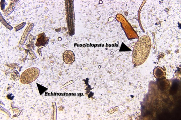 Image of <i>Fasciolopsis buski</i>