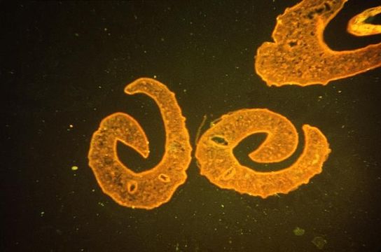 Image of Schistosoma