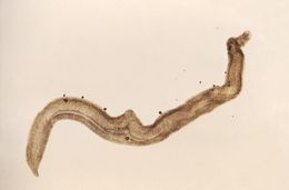 Image of Schistosoma