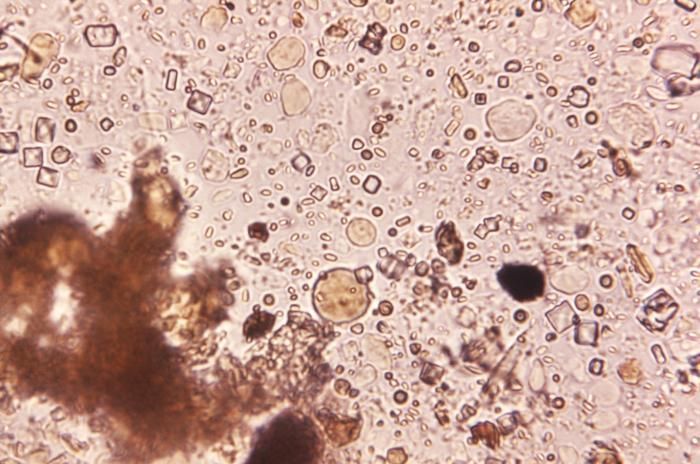 Image de Entamoeba coli