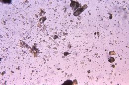 Image de Entamoeba coli