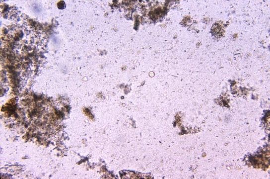 Image of Entamoeba coli
