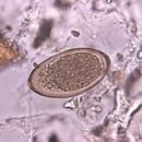 Слика од <i>Trichuris vulpis</i>