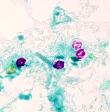 Image of Cryptosporidium Tyzzer 1907