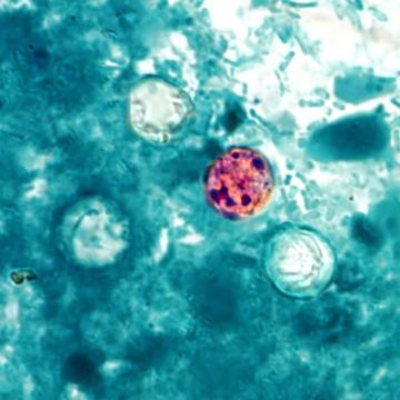 Image of Cyclospora cayetanensis