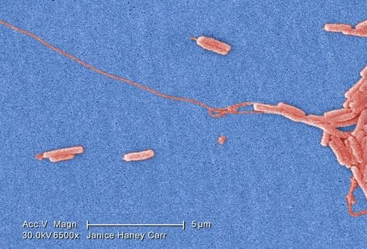 Image of Legionella