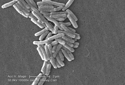 Image of Legionella pneumophila