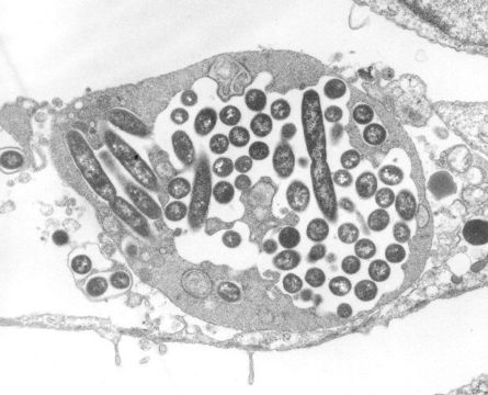 Image of Legionellaceae