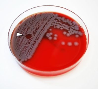 Image of Bacillus