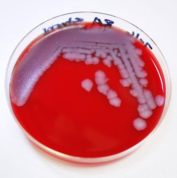 Image de Bacillus anthracis