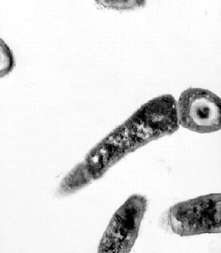 Image of Bacillus anthracis