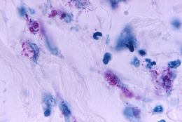 Image of Mycobacterium
