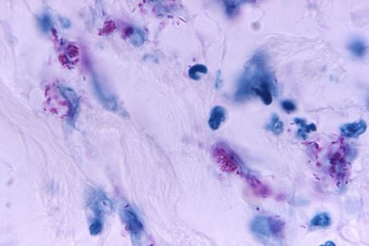 Image de Mycobacterium