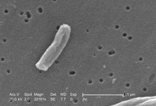 Image de Mycobacterium tuberculosis