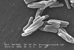 Sivun Mycobacterium tuberculosis kuva