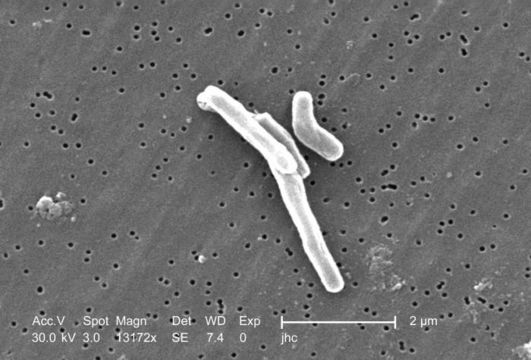 Image of Mycobacterium tuberculosis