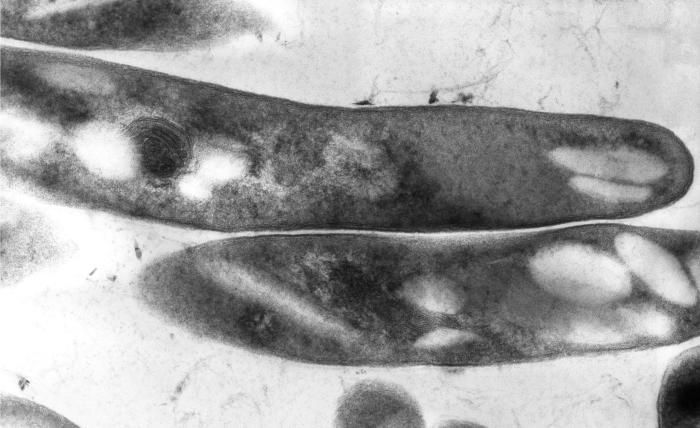 Image of Mycobacterium tuberculosis