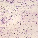Image of Peptostreptococcus
