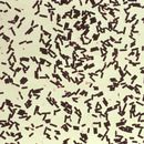 Image of Clostridium perfringens