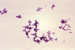 Image of Pseudoramibacter