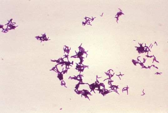 Image de Pseudoramibacter