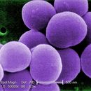 Image of Staphylococcus aureus
