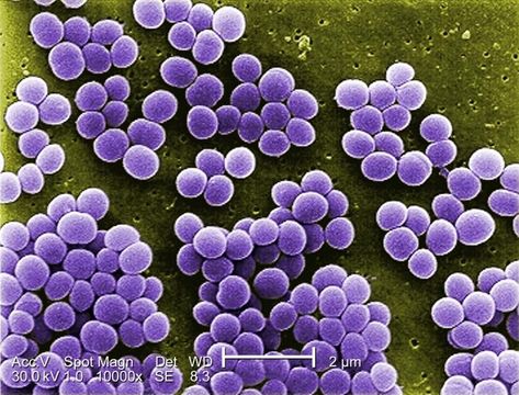 Image of Staphylococcus