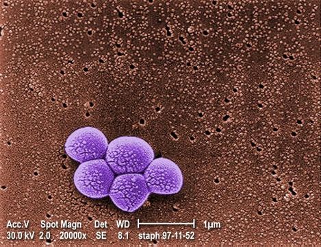 Image of Staphylococcus