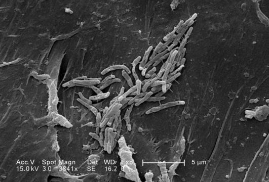 Image de <i>Mycobacterium fortuitum</i>