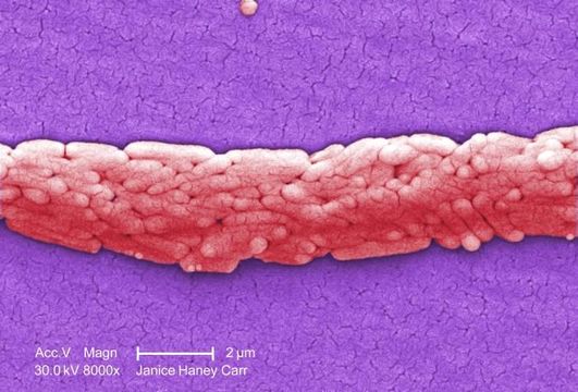 Image de Enterobacteriaceae