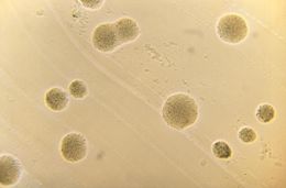 Image of Actinomyces viscosus