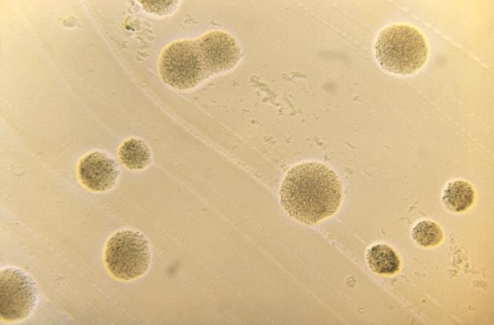 Actinomyces viscosus resmi