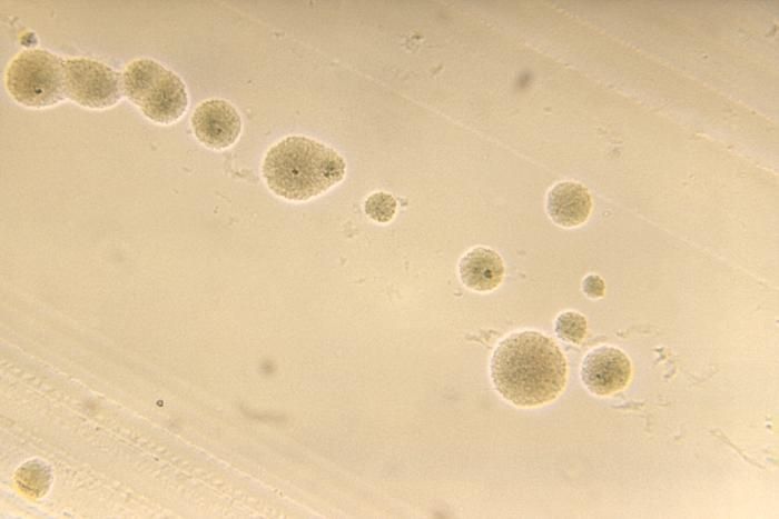 Actinomyces viscosus resmi