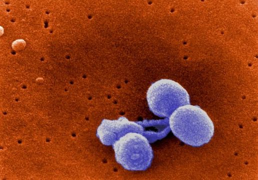 Image of Streptococcus