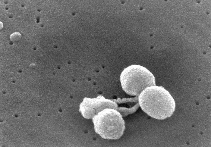 Image of Streptococcus