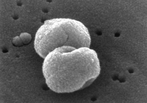 Image of Streptococcus