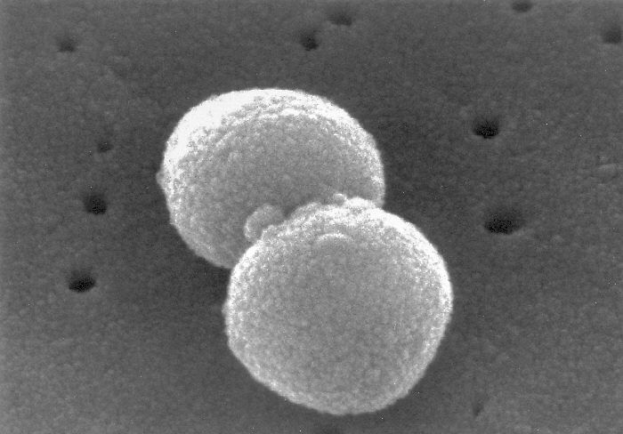 Imagem de Streptococcus pneumoniae