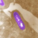 Image of Listeria monocytogenes