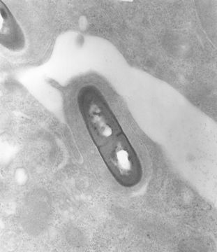 Image de Listeria